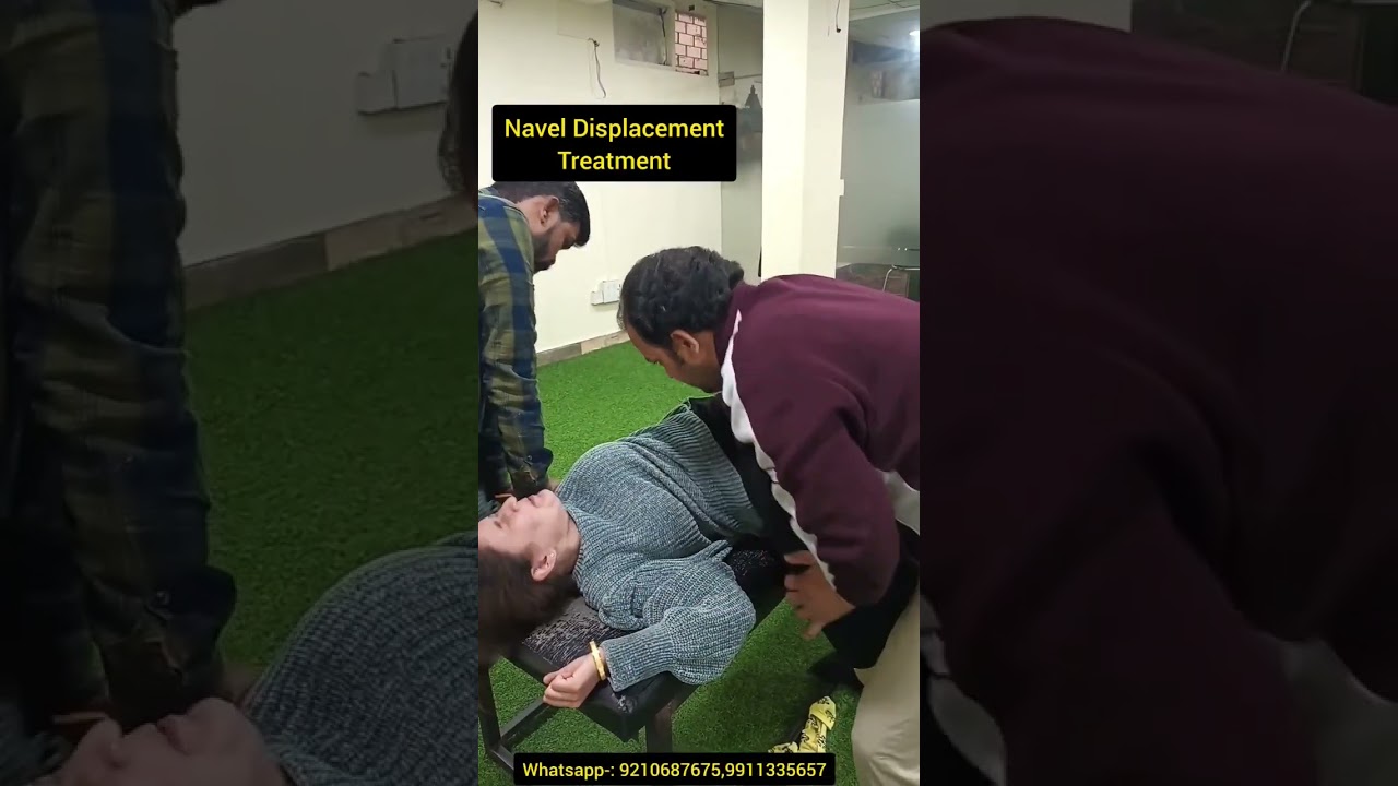 Navel displacement treatment. #naveldisplacement #naveldisplacementtreatment #youtubeshorts #shorts