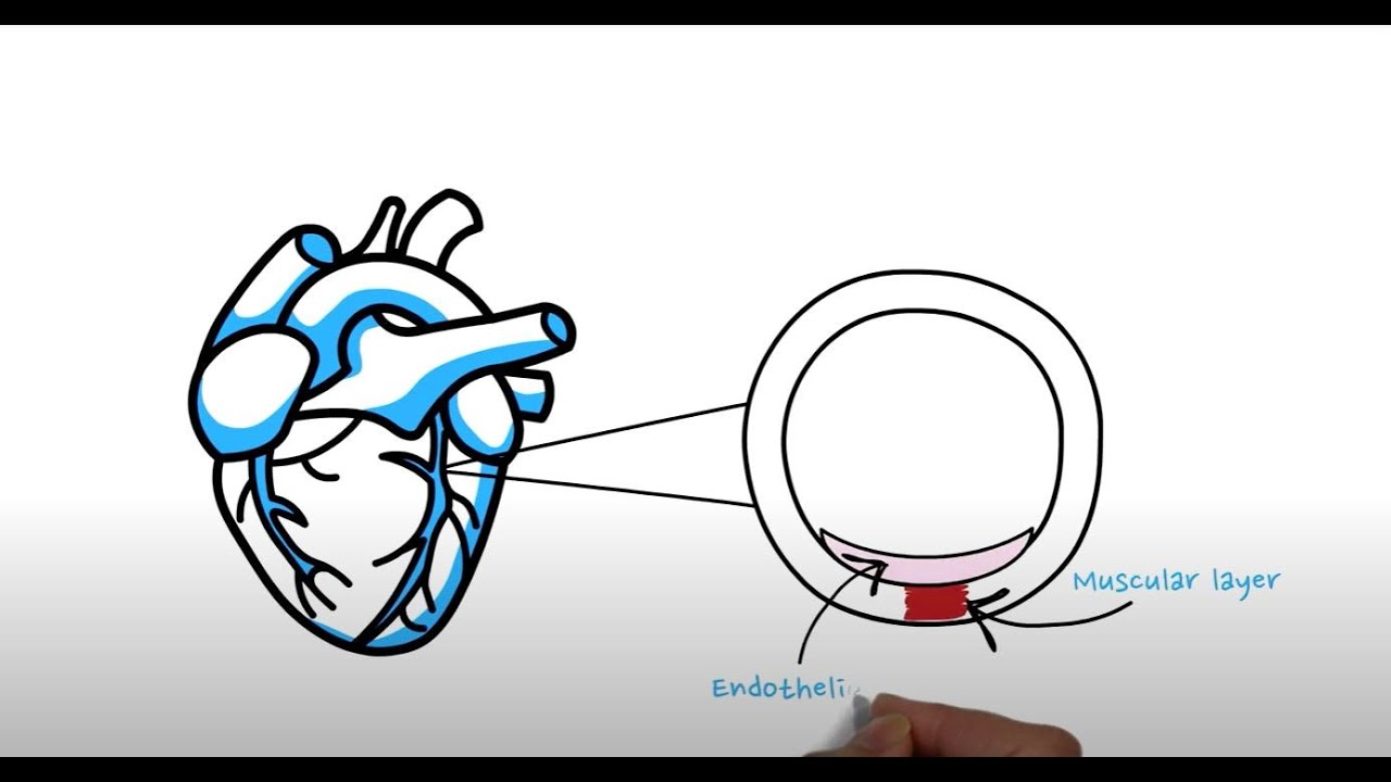 What is a Coronary Calcium Score?