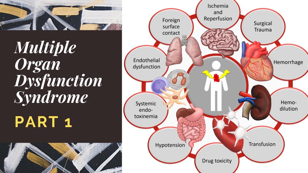 Multiple Organ Dysfunction Syndrome (MODS) | Part 1