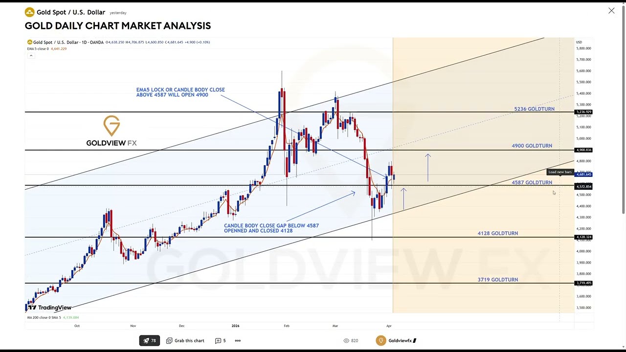 XAUUSD Gold Analysis Today 🔥 Key Levels & Trade Setup (Don&rsquo;t Miss This!)