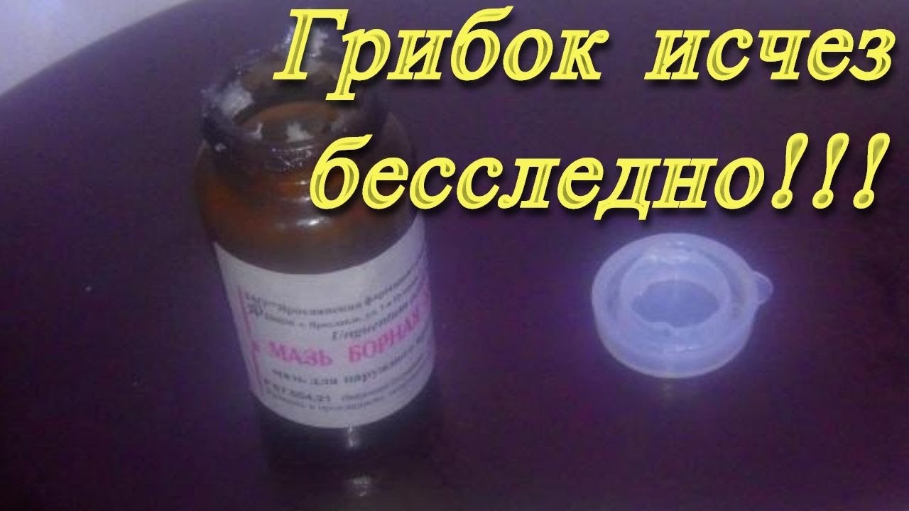 Купила в Аптеке Копеечную Борную Мазь и избавилась от Грибка Ногтей раз и Навсегда!