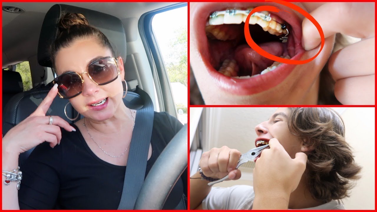 KENDRY BROKE HIS BRACKETS WHILE QUARANTINED AT HOME .VLOG#379