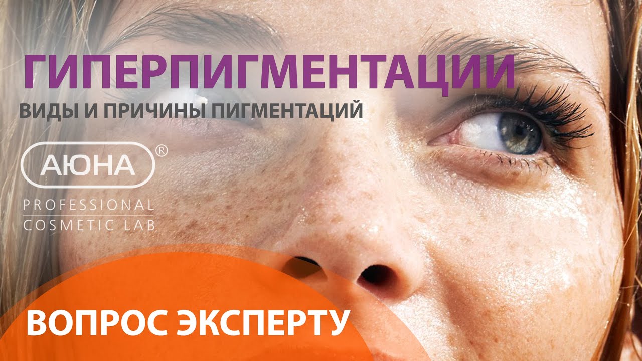 ГИПЕРПИГМЕНТАЦИИ: вопрос ЭКСПЕРТУ