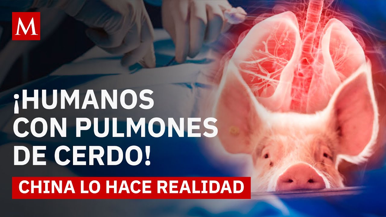 Hist&oacute;rico trasplante en China: as&iacute; hicieron funcionar un &oacute;rgano animal en un humano