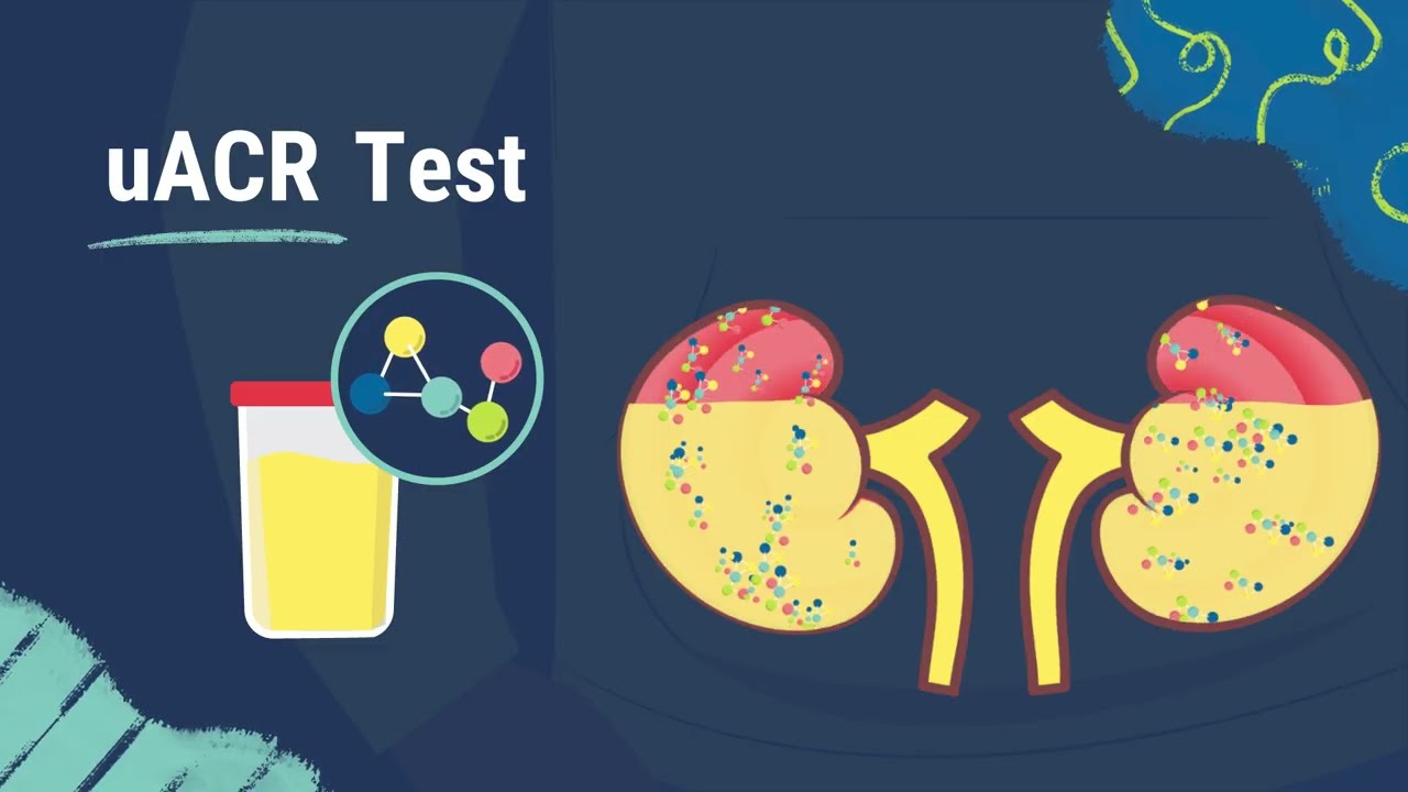 What is uACR Testing?
