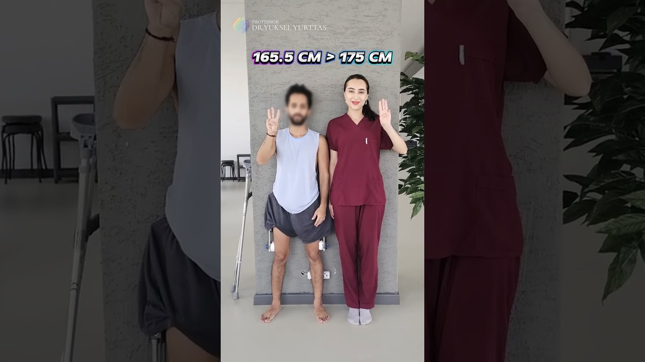 9.5 cm Taller! Leg Lengthening Surgery Before & After