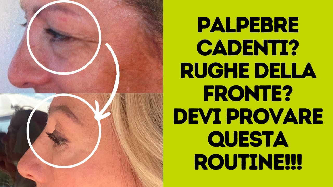 Palpebra cadente e rughe della fronte: fai questa routine e comincia a vedere risultati!