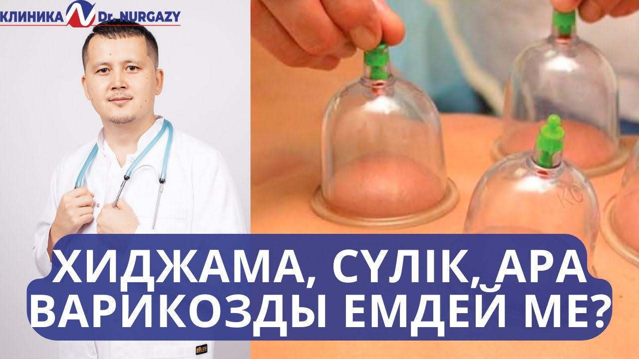 ХИДЖАМА, СҮЛІК, АРА ВАРИКОЗДЫ ЕМДЕЙ МЕ?