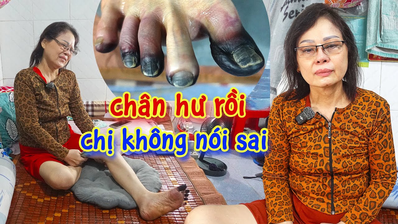 Quá Khổ Chị Loan Khẳng Định Không Ăn Chơi Trác Táng, Không Nói Sai Sự Thật.. Hành Hung Chồng Con