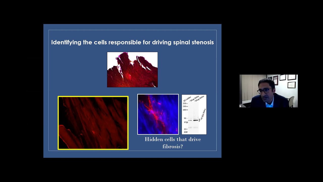 Clinical and Research Advances in Complex Spine Surgery at Mass General - Jan. 12, 2021