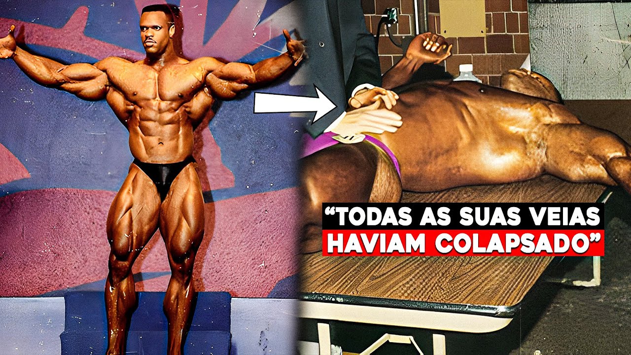 O que Aconteceu com Paul Dillett?!