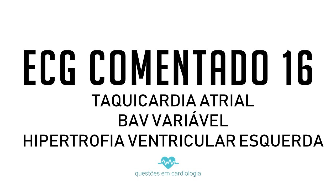 ECG Comentado 16 - Taquicadia atrial / BAV variável / HVE