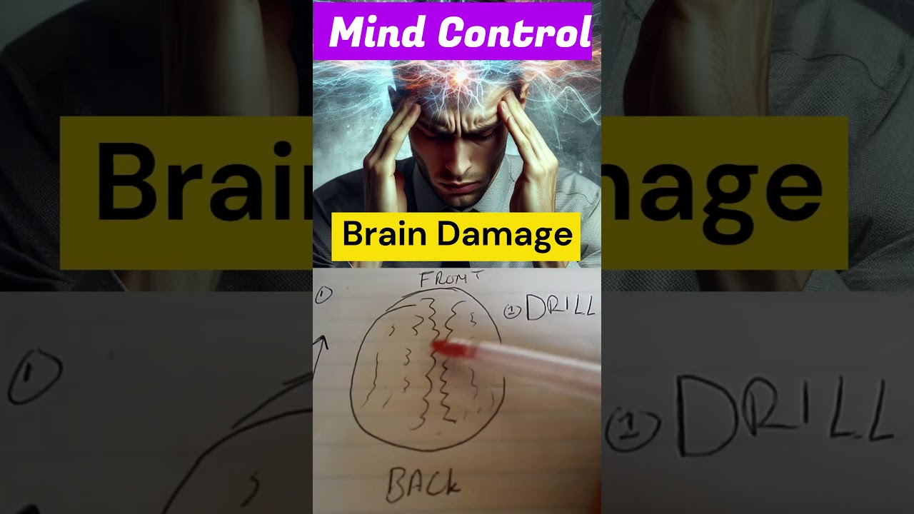 Targeted Individual - Mind Control means Brain Damage 