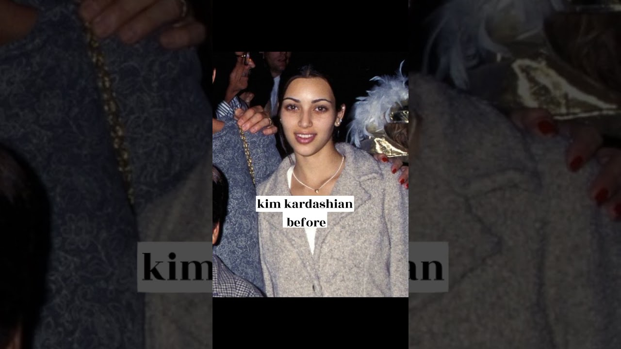 kardashians before and after surgery 