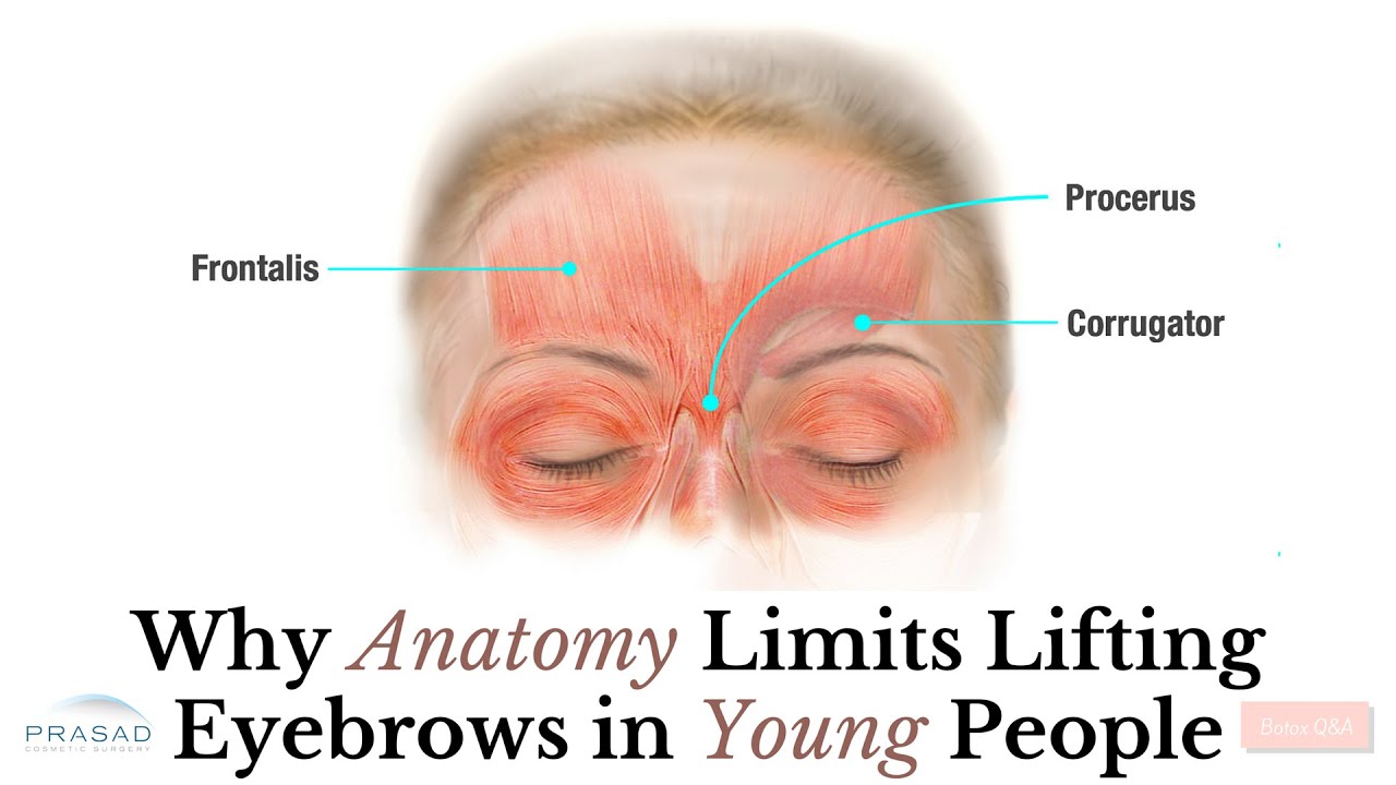 Why Lifting the Eyebrows is Limited by Anatomy and Young Skin