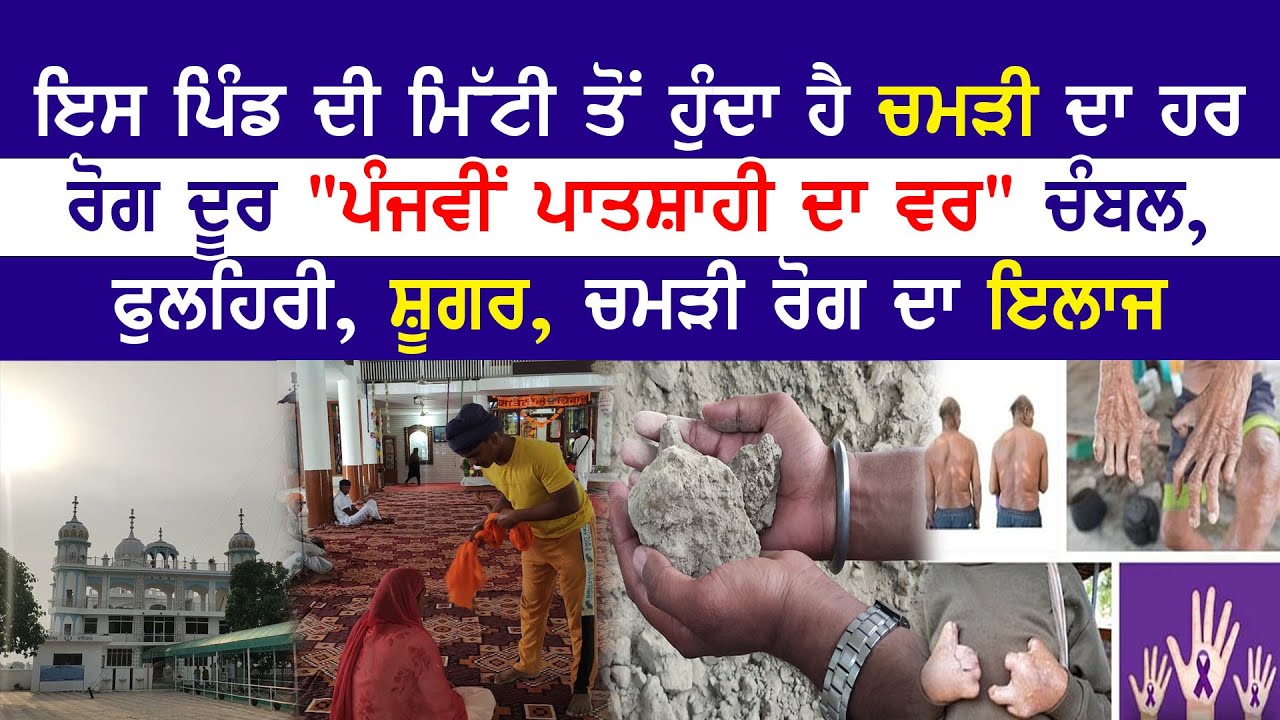 ਇਸ ਪਿੰਡ ਦੀ ਮਿੱਟੀ ਤੋਂ ਹੁੰਦਾ ਹੈ ਚਮੜੀ ਦਾ ਹਰ ਰੋਗ ਦੂਰ, ਚੰਬਲ, ਫੁਲਹਿਰੀ, ਸ਼ੂਗਰ ਚਮੜੀ ਰੋਗ ਦਾ ਇਲਾਜ !