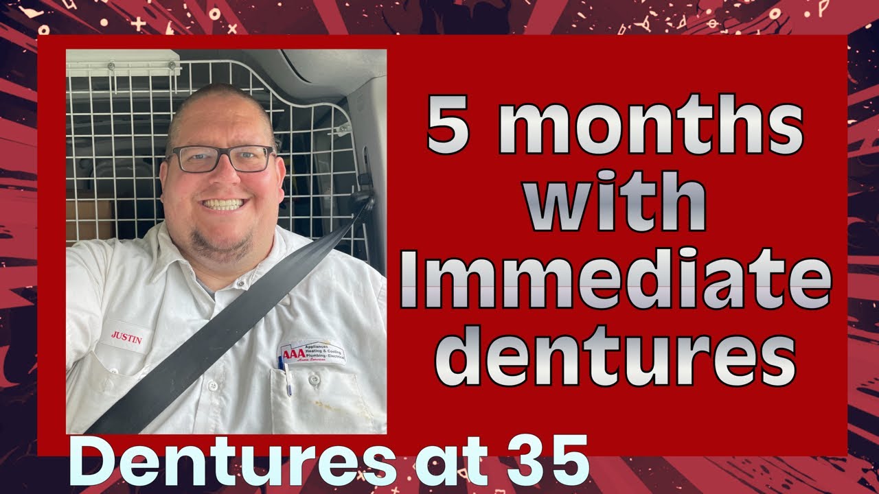5 months with immediate dentures. What have things been like? Dentures at 35
