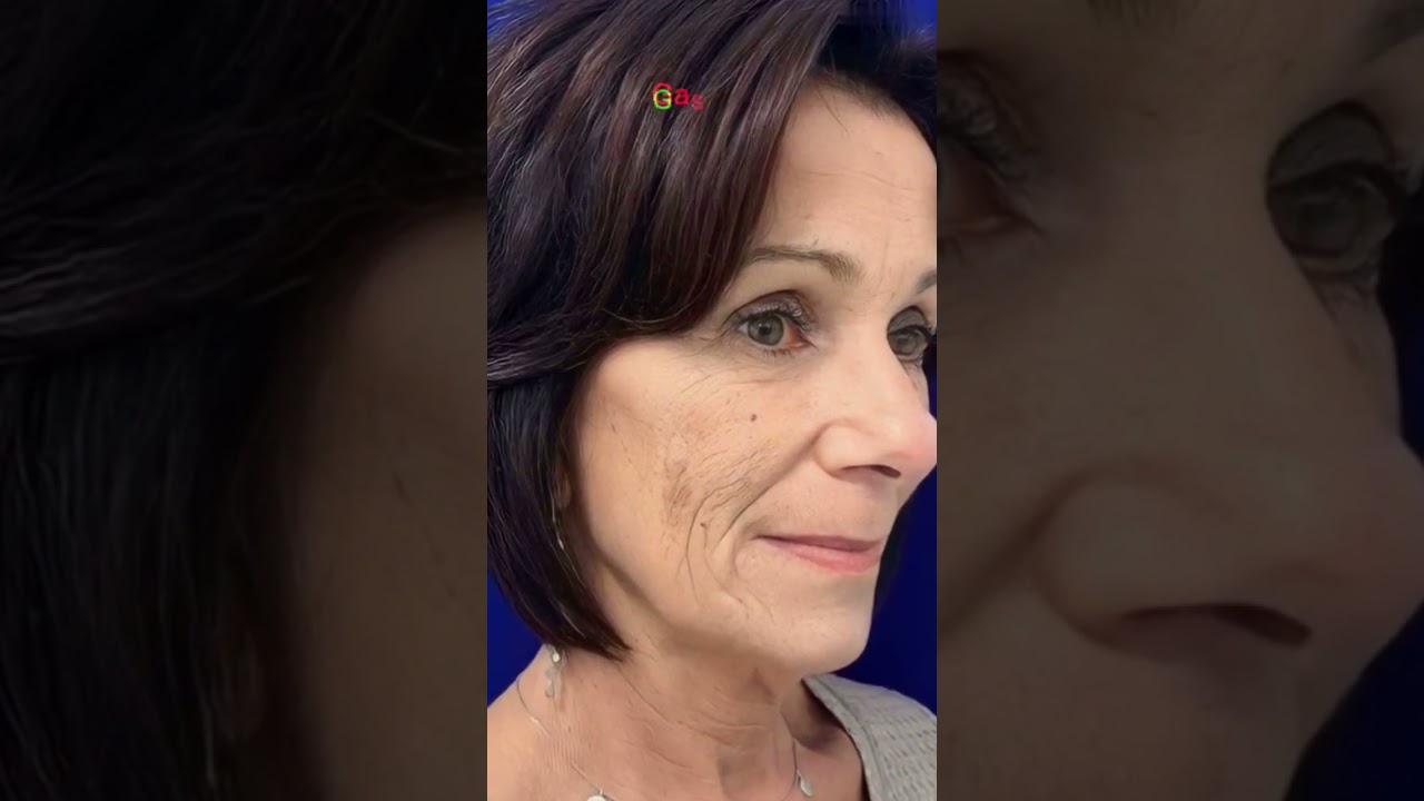 rejuvenescimento com 50 anos