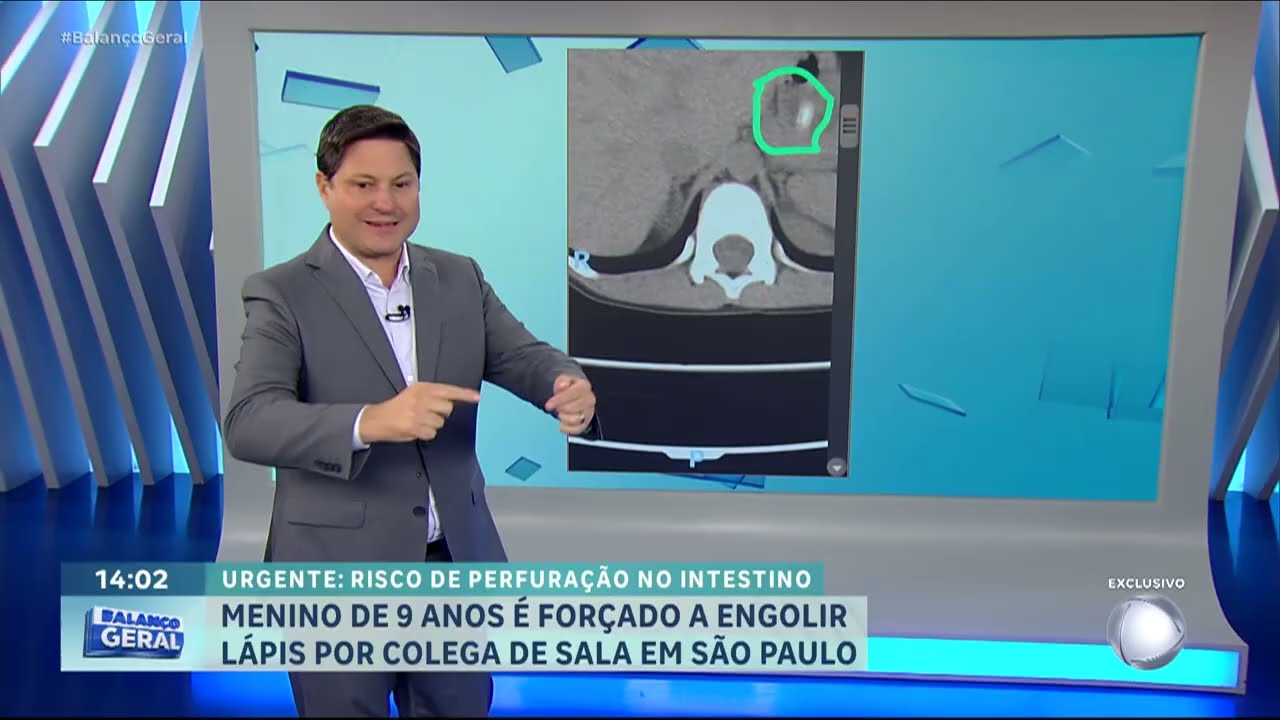 Menino de 9 anos é forçado por colega a engolir lápis em escola de São Paulo
