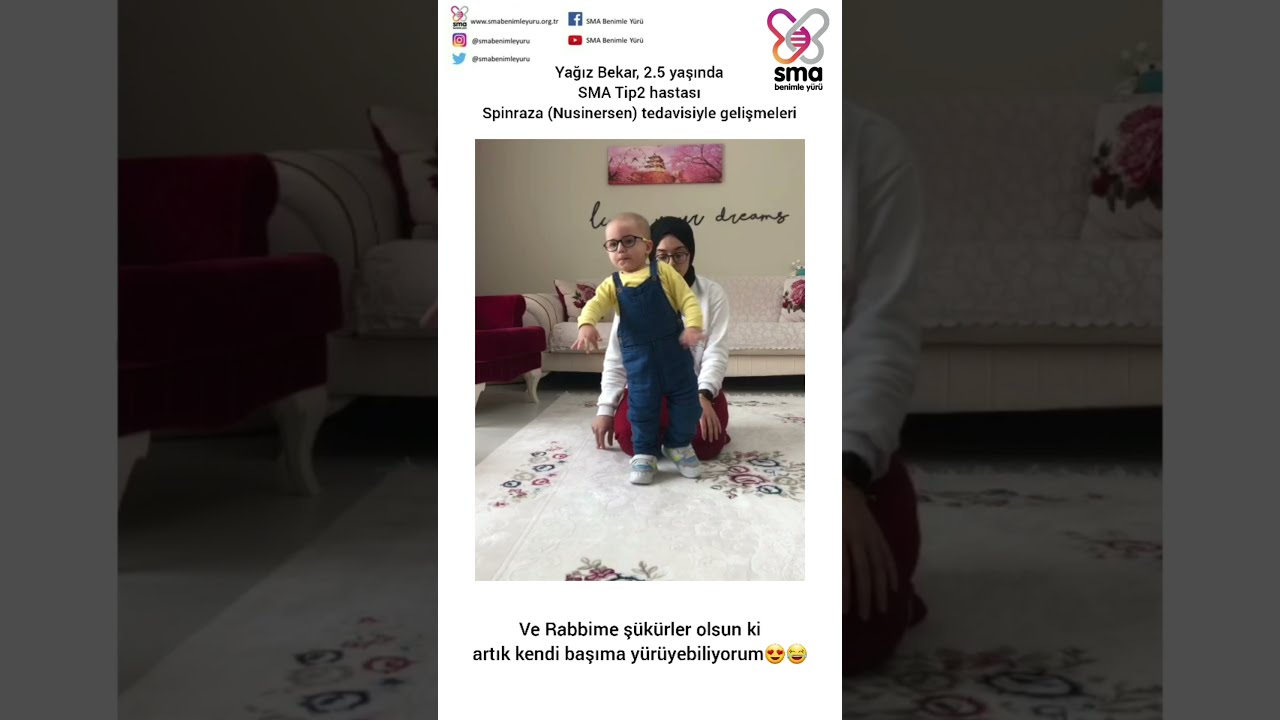 SMA Tip2 hastası Yağız’ın Spinraza (Nusinersen) tedavisiyle gelişimi