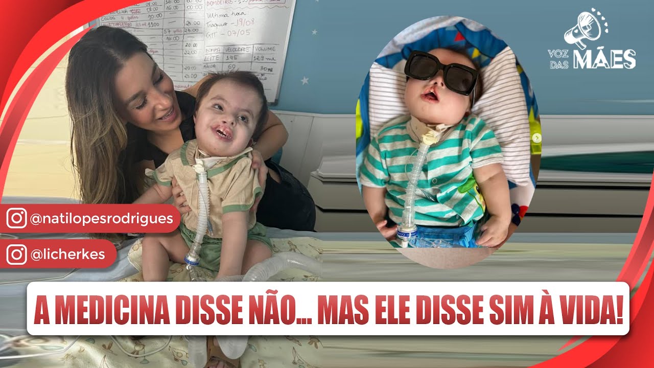 SÍNDROME DE EDWARDS: DISSE QUE ELE NÃO ERA COMPATÍVEL COM A VIDA