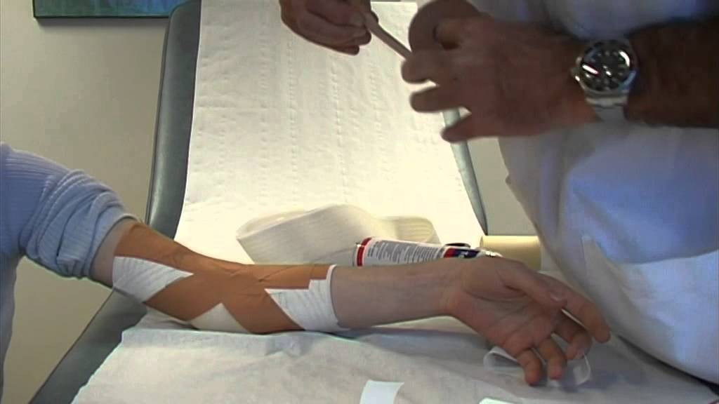 Strapping du coude