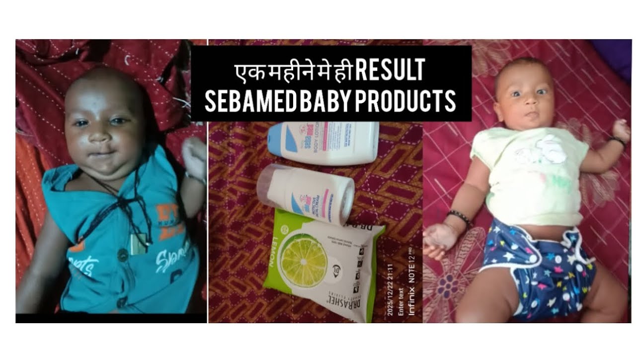 जादू हो गया क्या product h kas phele पता होता फुल review sebamed baby product baby mssase 
