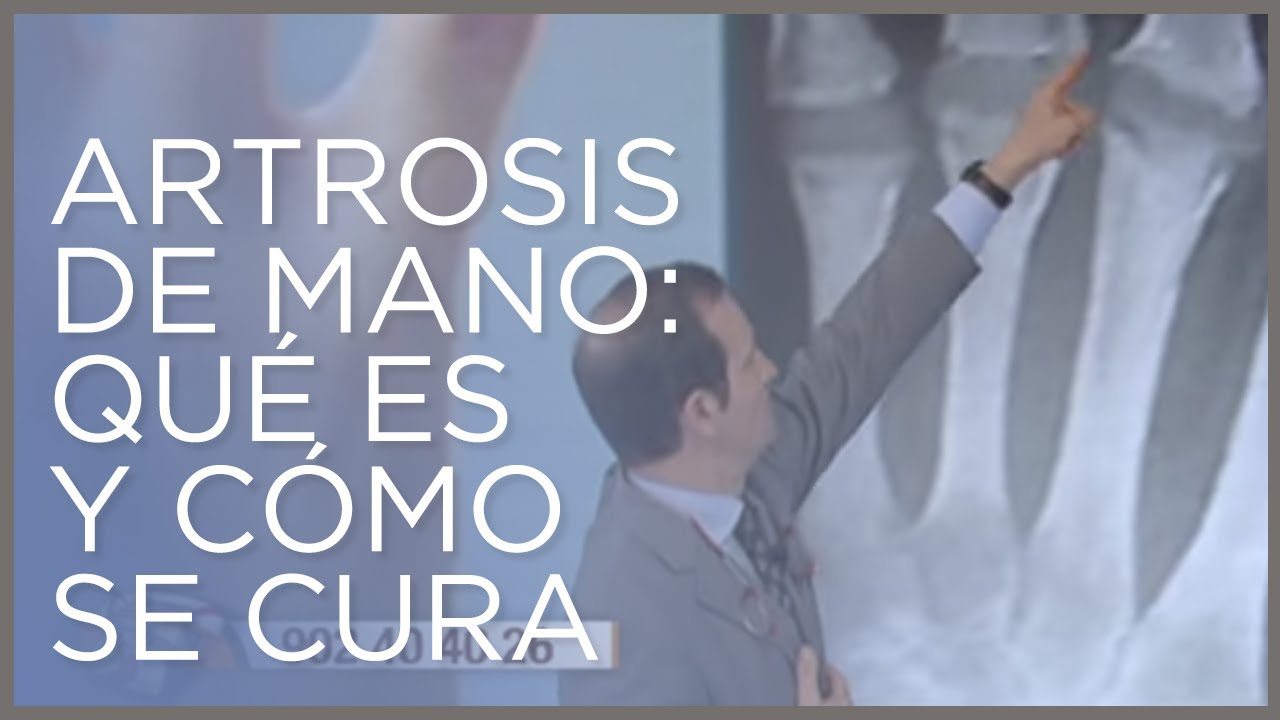 Artrosis de mano: qué es y cómo se cura (por el Dr. Villamor en Saber Vivir)