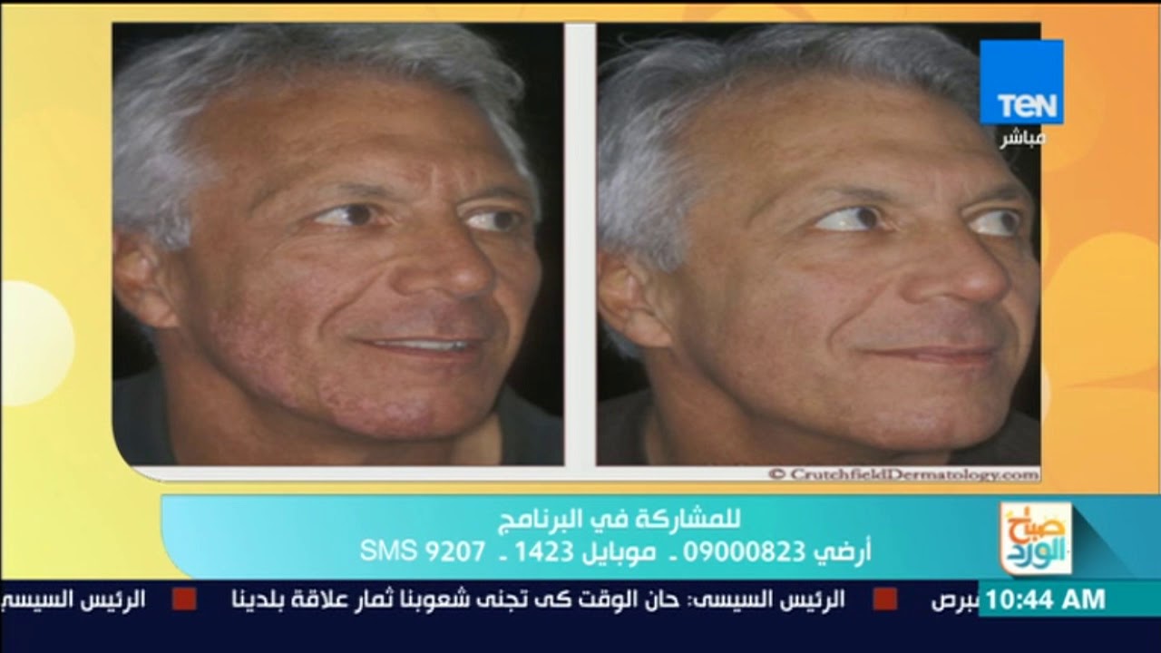 صباح الورد - فقرة خاصة عن 