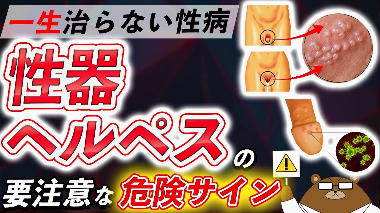 絶対に見逃してはいけない性器ヘルペスが引き起こす体の変化。初期の危険サインとは？予防法とは？医師が徹底解説！