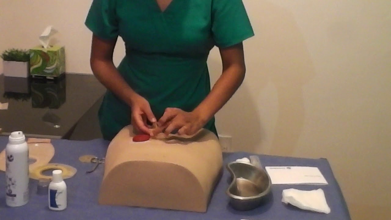 Cambio de Kit de Ostomía: Guía Completa Paso a Paso para Evitar Fugas y Proteger tu Piel