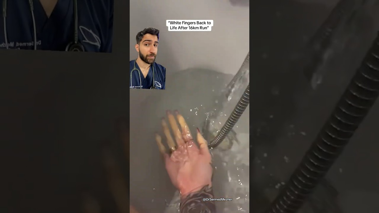 &ldquo;You Just Have Cold Hands&rdquo; #wait
