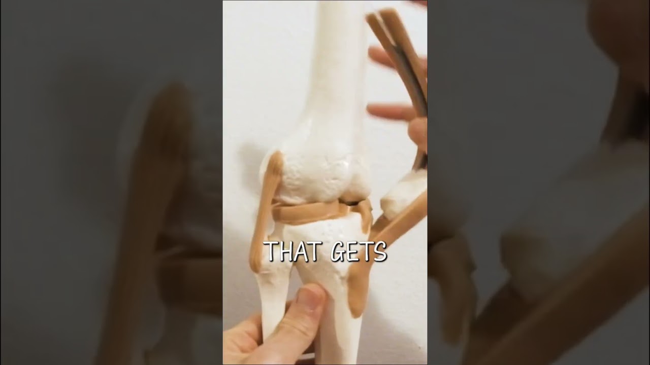 Звук хруста колена #вашездоровье #нашездоровье #здоровьеколена