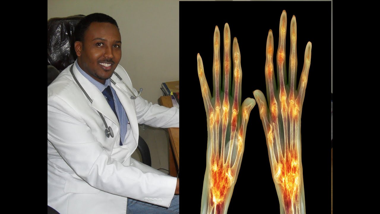 sida ugu haboon ee aad ula tacaalayso  khatarta roomatisamka(rheumatism)
