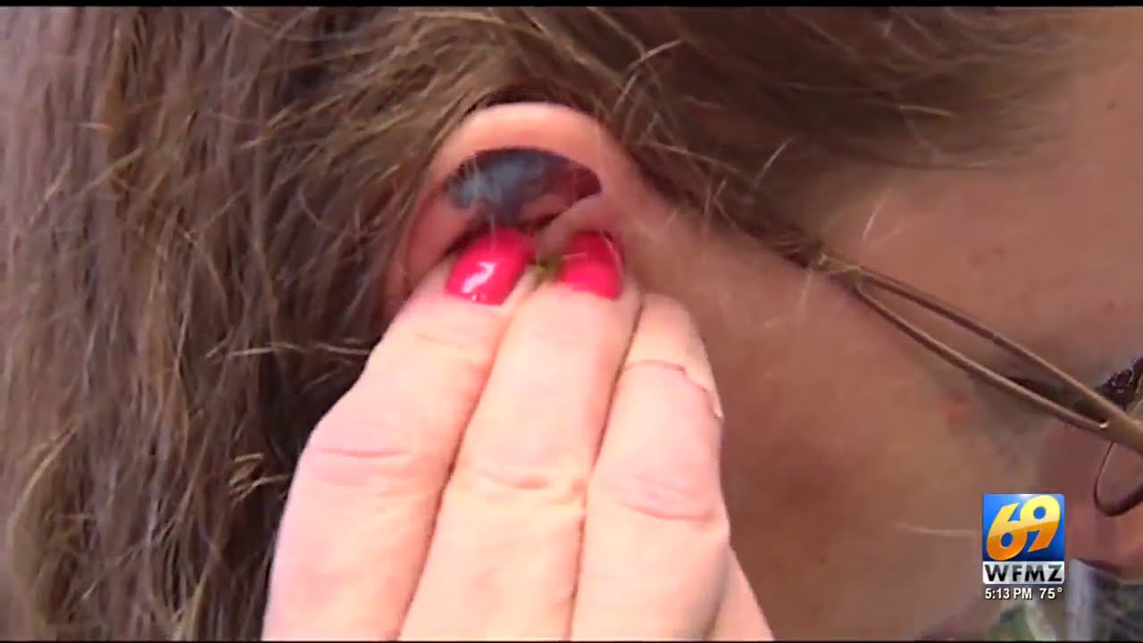 One Day Without Sound 2018 | Raising Awareness With Miracle-Ear Foundation&reg;