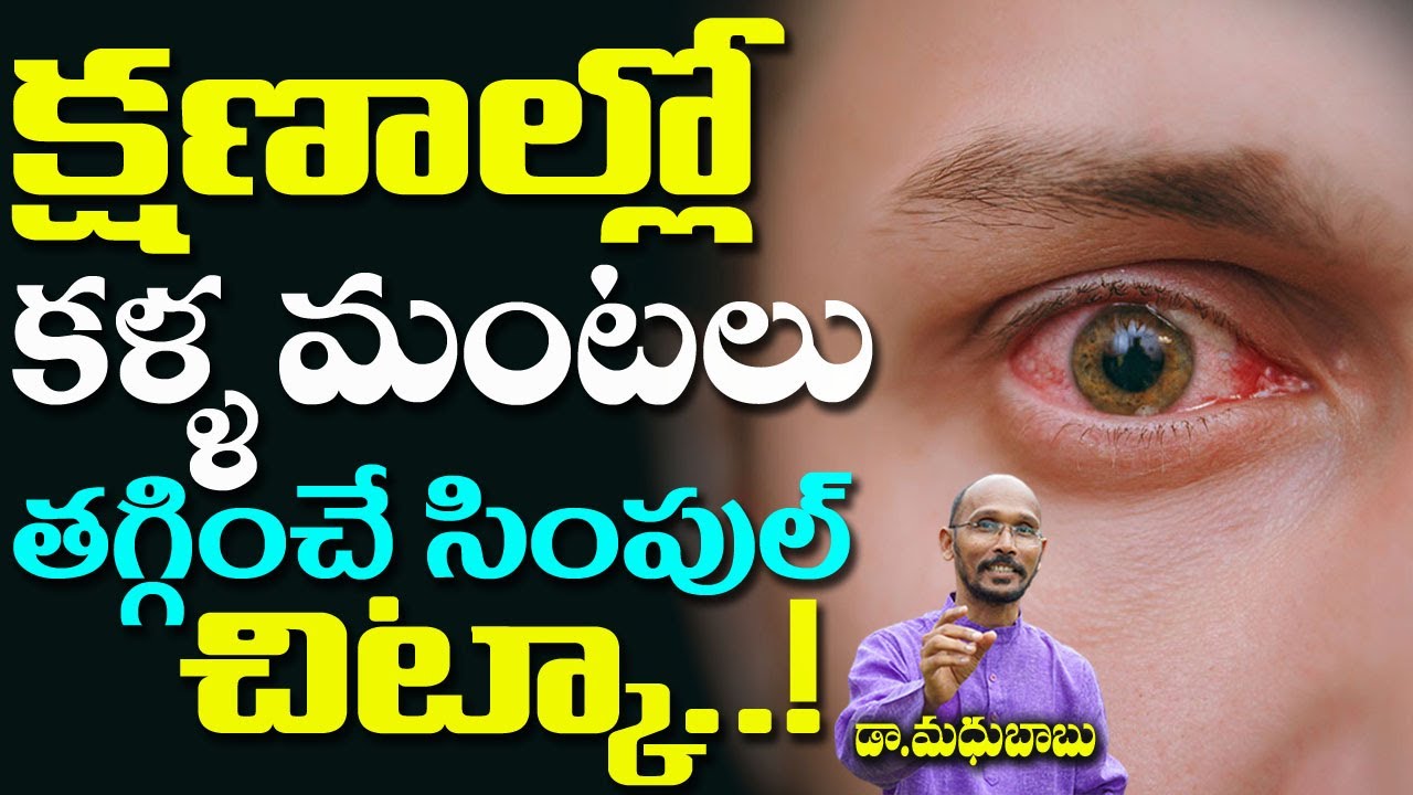 క్షణాల్లో కళ్ళ మంటలు తగ్గించే సింపుల్ చిట్కా | Dr. Madhu Babu | Health Trends |