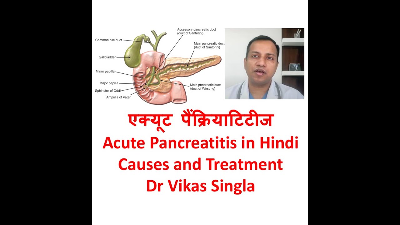 Acute Pancreatitis, Treatment and Causes in Hindi, By Dr Vikas Singla, Max Hospital, New Delhi