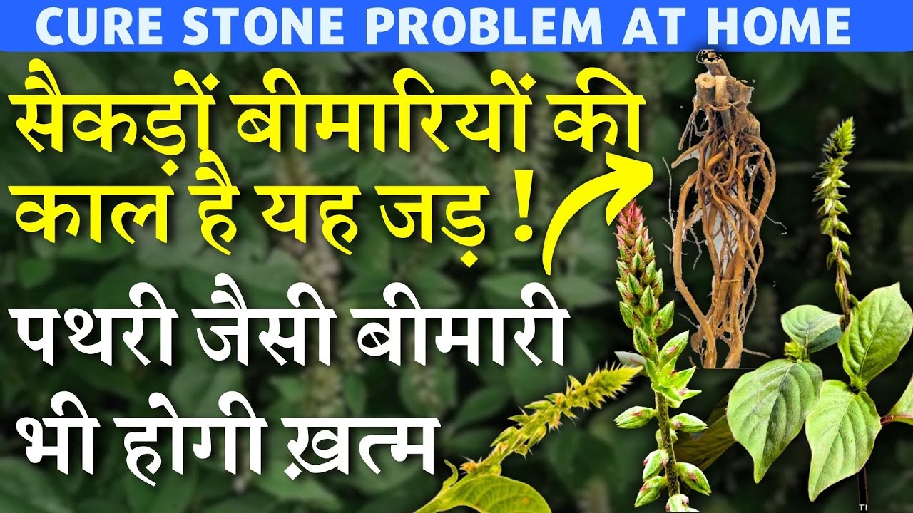 सैकड़ों बीमारियों की काल है यह जड़ || पथरी जैसी बीमारी भी होगी ख़त्म || Free Solution for Stone
