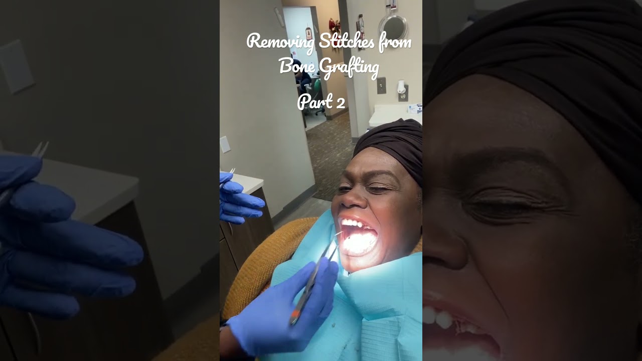 Removing Stitches from Bone Grafting, they ready to go..