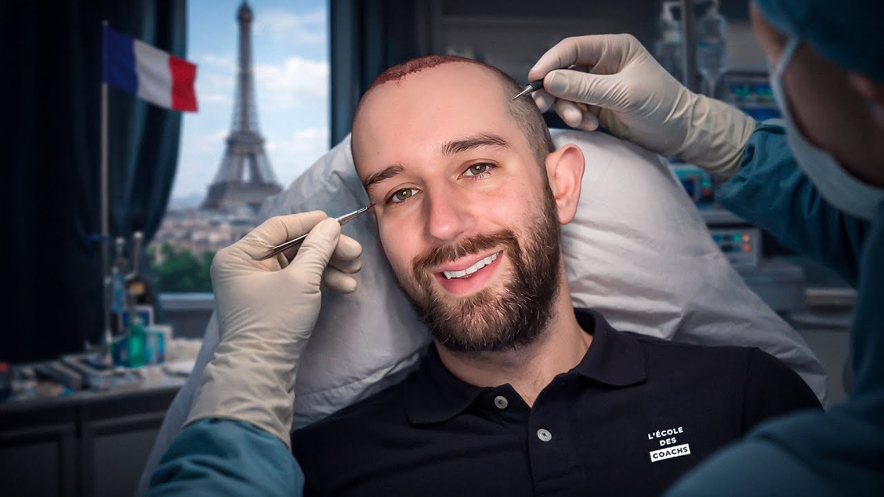 Ce que ma greffe de cheveux m’a appris sur l’expérience client 5 étoiles 