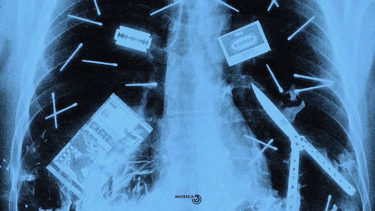 104 - Копер (ft. qurt) [Минус] Remake by Radames