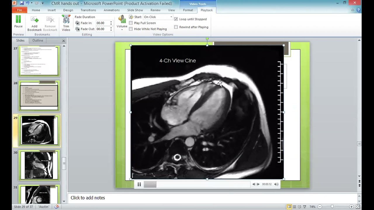 Tracings for Exam - Prof. Hesham Yehia - Dr. Ahmed Asfour