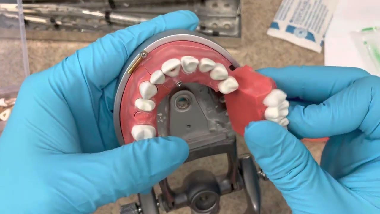 How to pass the CDCA ADEX Dental Exam Part 1 Pieces