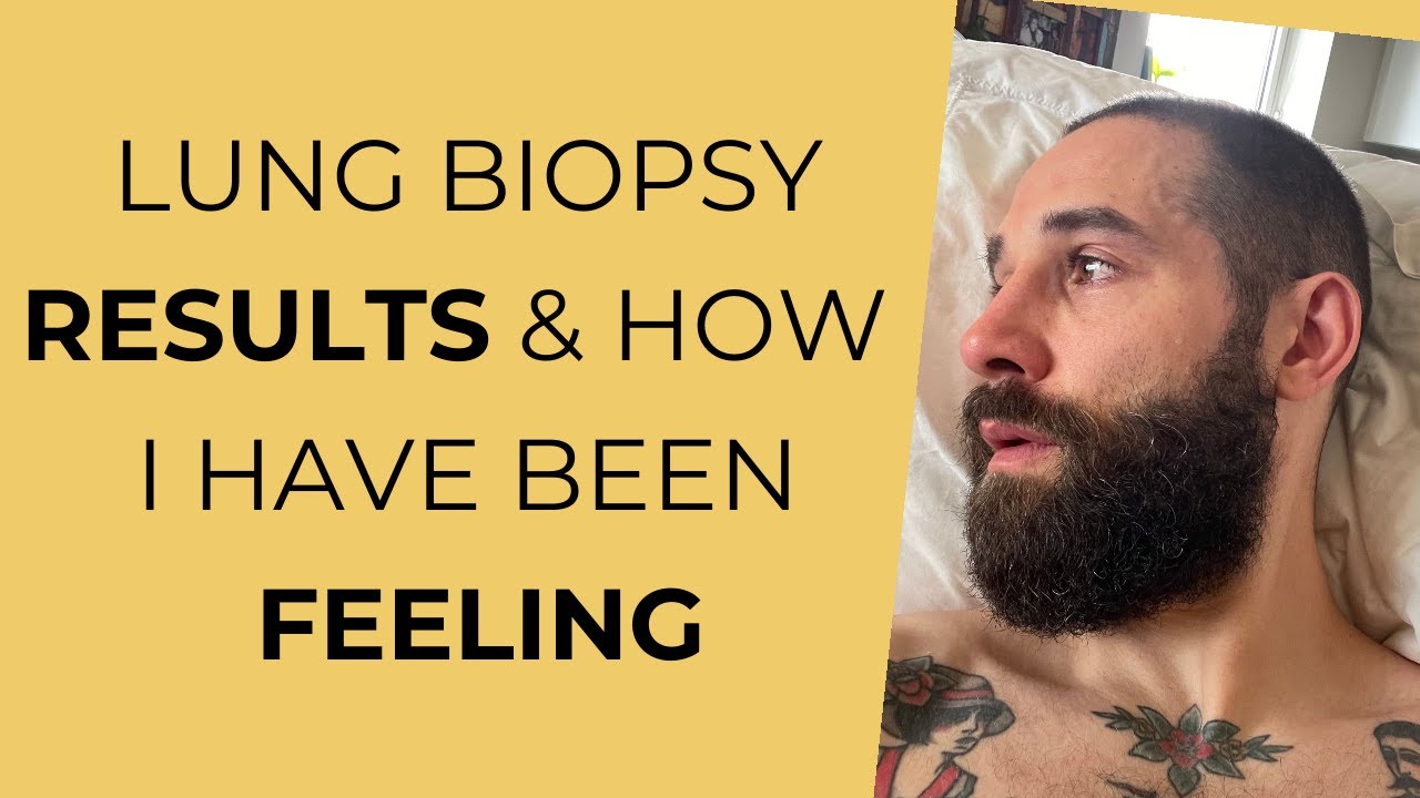 Update | Lung Biopsy Results & How I Have Been Feeling