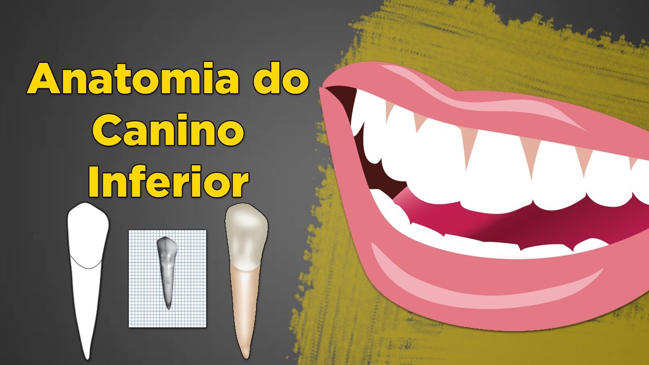 Anatomia do Canino Inferior - Resumo de Anatomia Dental - Dente 33 e 43