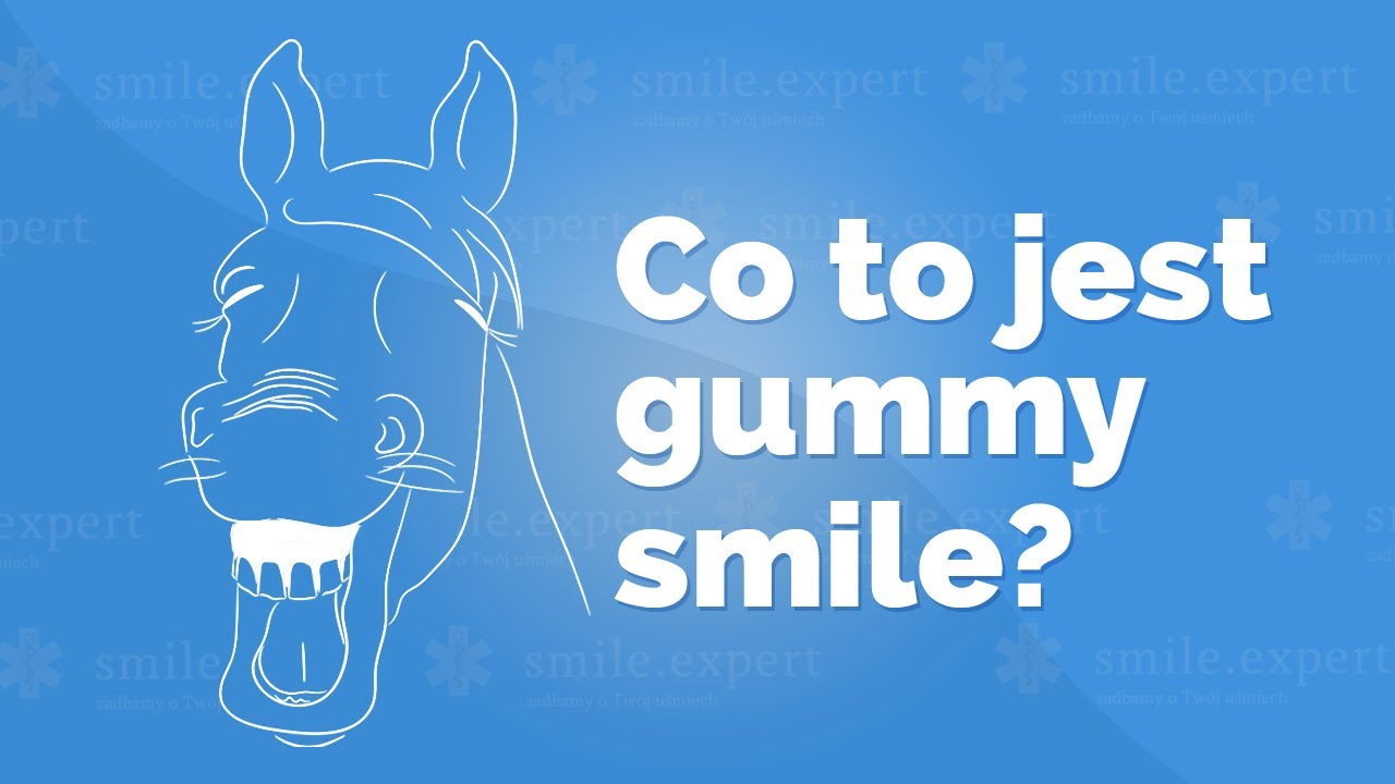 💎 Co to jest gummy smile? | smile.expert