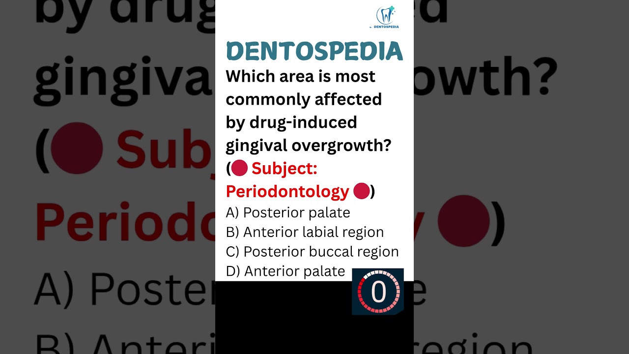 Periodontology MCQ for Dental Board Exams #Periodontology #Periodontologymcqs #dentospedia #afk #adc