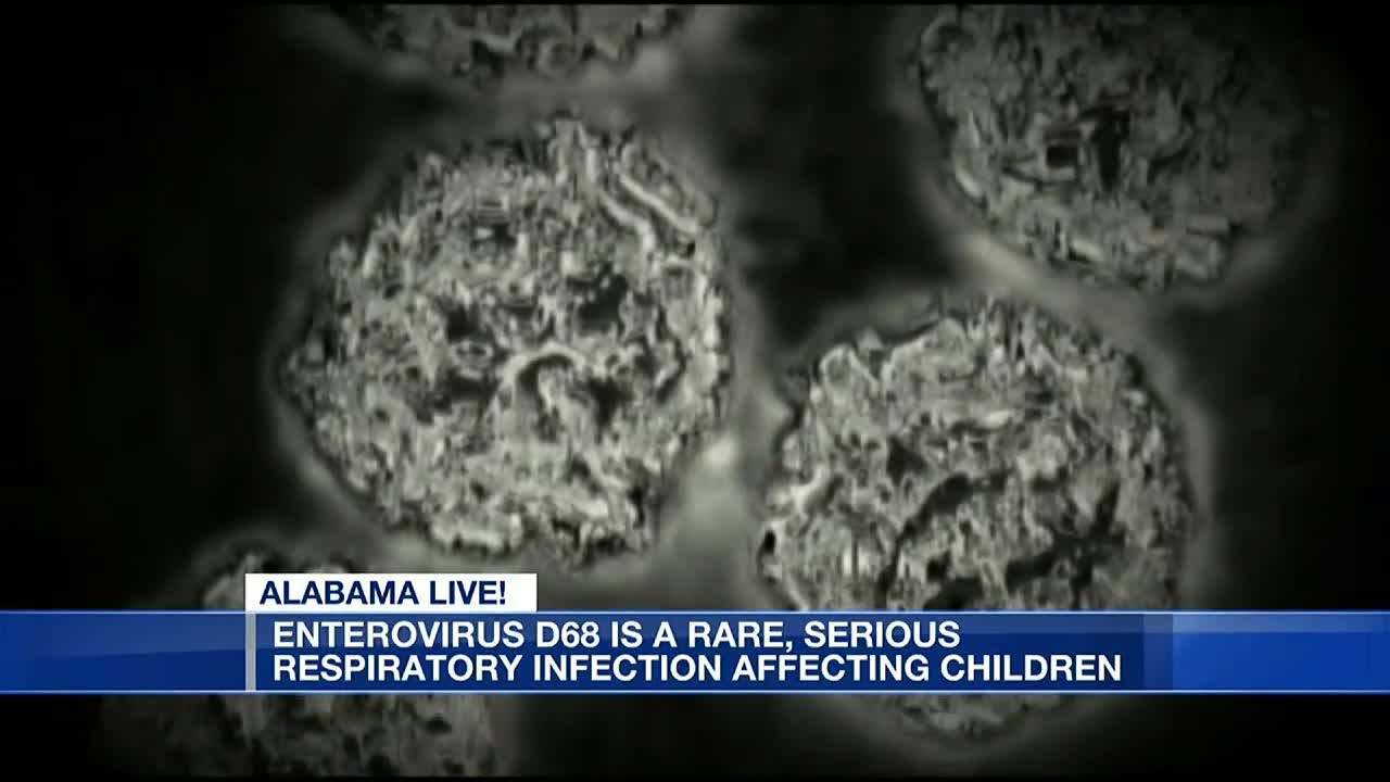 Enterovirus D68 is a rare, serious respiratory infection affecting children