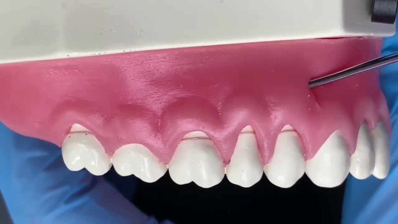 Instruments for Periodontal Tunneling Surgery - Vanessa Frazão - Supremo Instrumentos