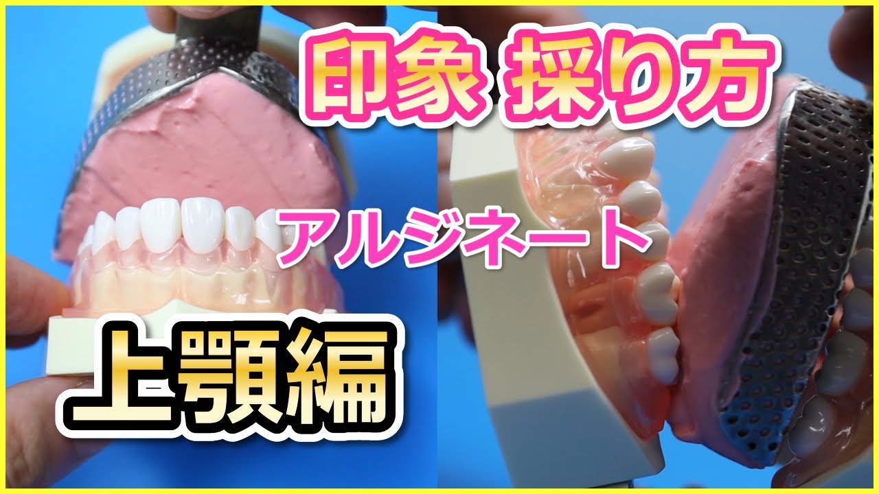 【印象採得】【上顎】【決定版】【歯科衛生士 楽しく働こ】 Dr.デン山のDHスクール 楽しく働こ!!